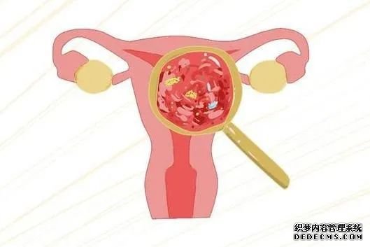 阴道分泌物检测仪